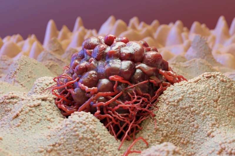 3D render of cancer cells growing uncontrollably over tissue, illustrating tumor infection, invasive metastasis, and melanoma cancerous spread.