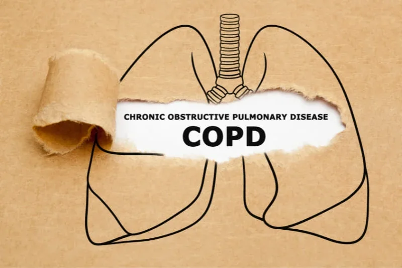 Anatomical diagram of lungs showing Chronic Obstructive Pulmonary Disease (COPD) affecting respiratory function.