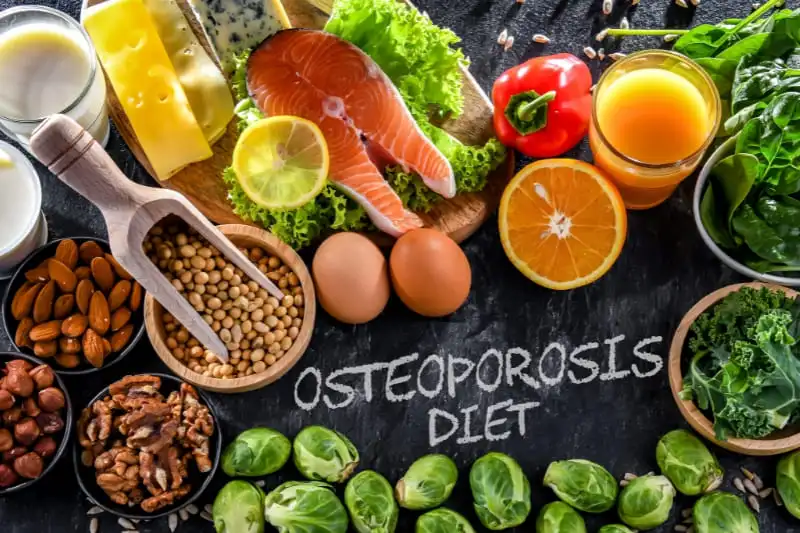 Healthy foods for osteoporosis prevention arranged on dark background with "OSTEOPOROSIS DIET" written in chalk, featuring calcium-rich dairy, salmon, nuts, vegetables, and citrus fruits.